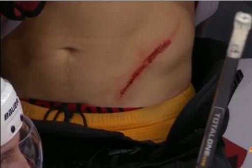 Schenn cut