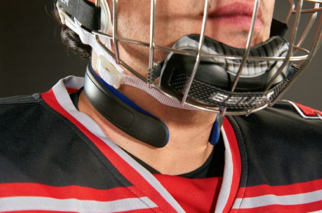 Concussions